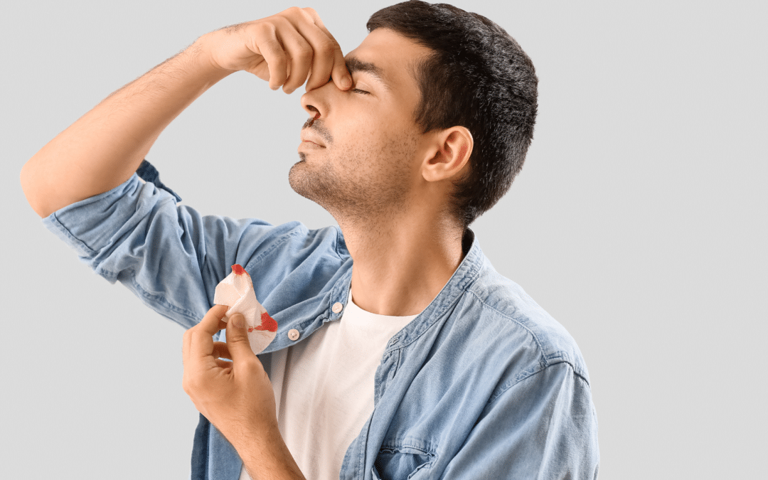 How to Stop and Prevent Nosebleeds