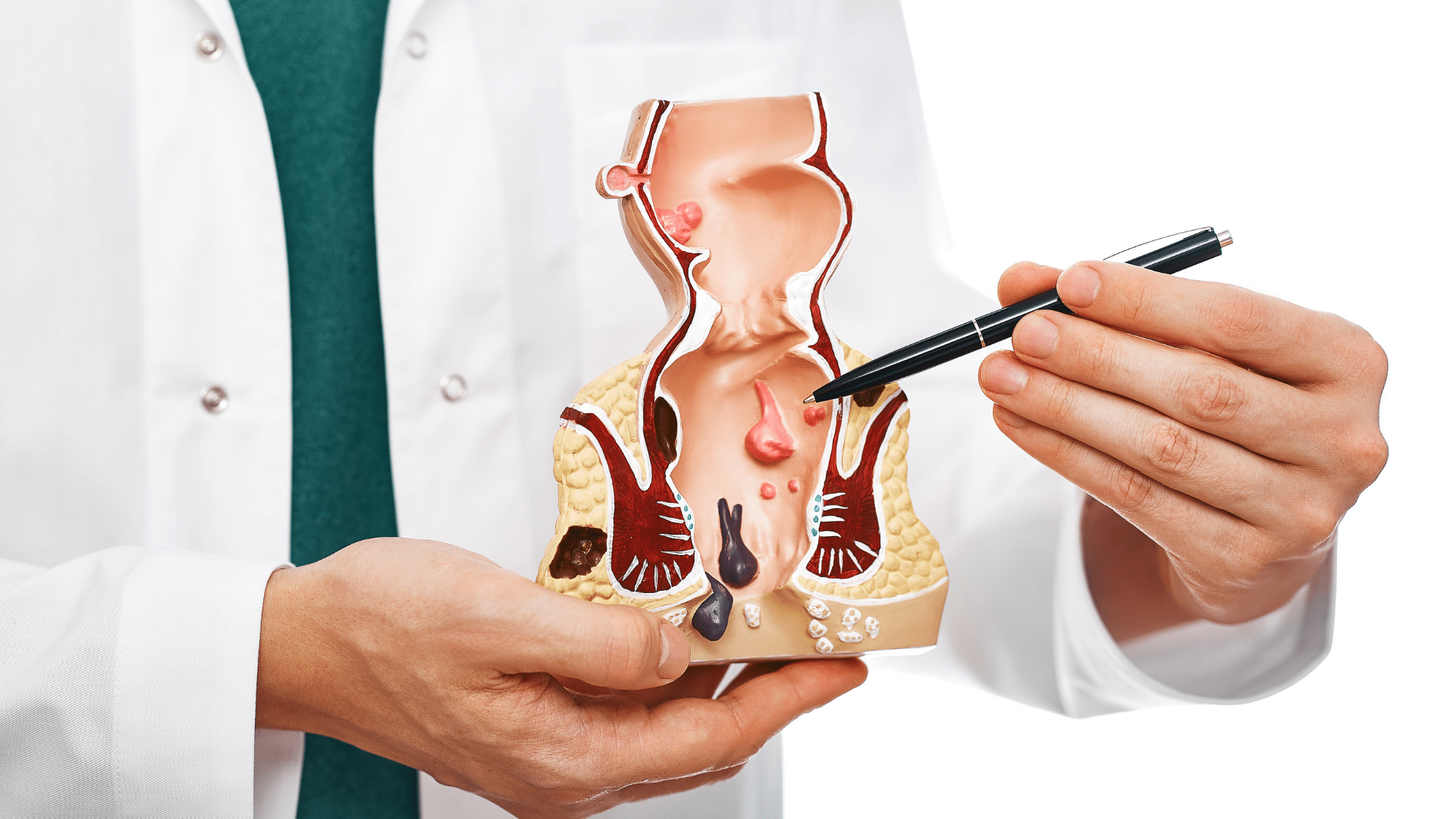 Nasal polyps removal